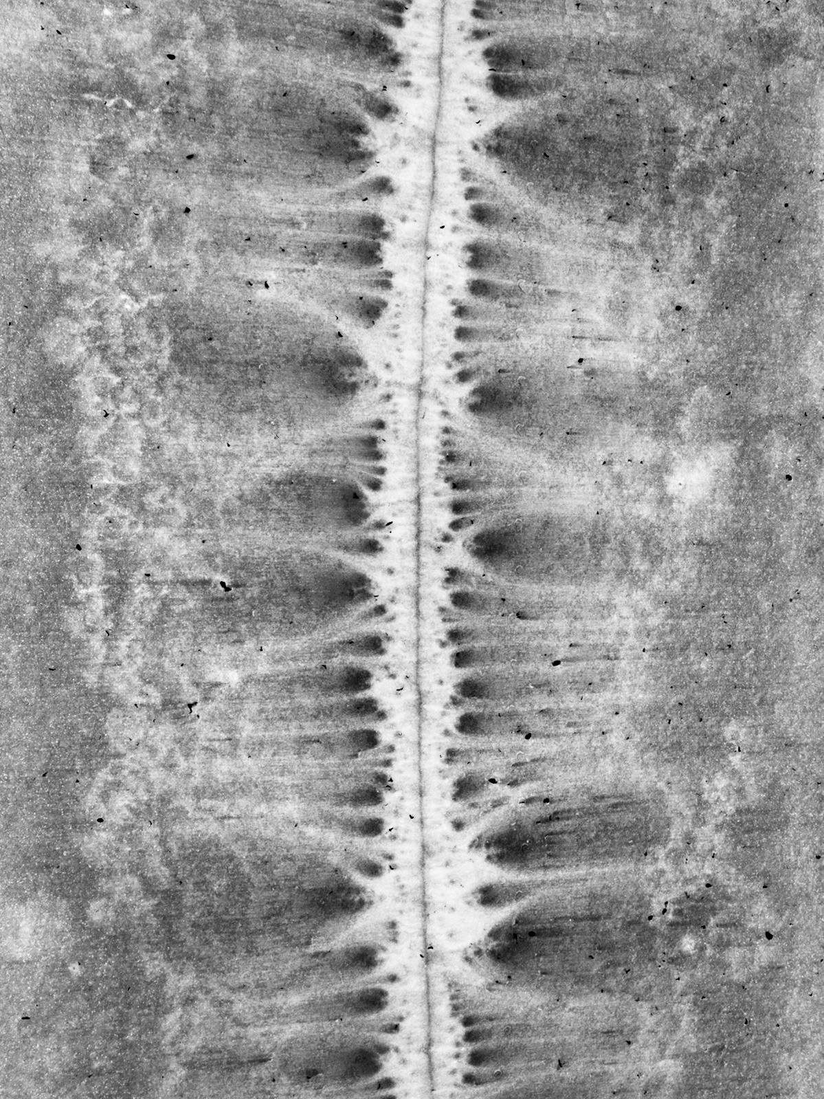 X-Ray
